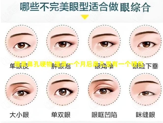 隆鼻鼻孔硬物 隆鼻一个月后鼻孔里有一个硬包